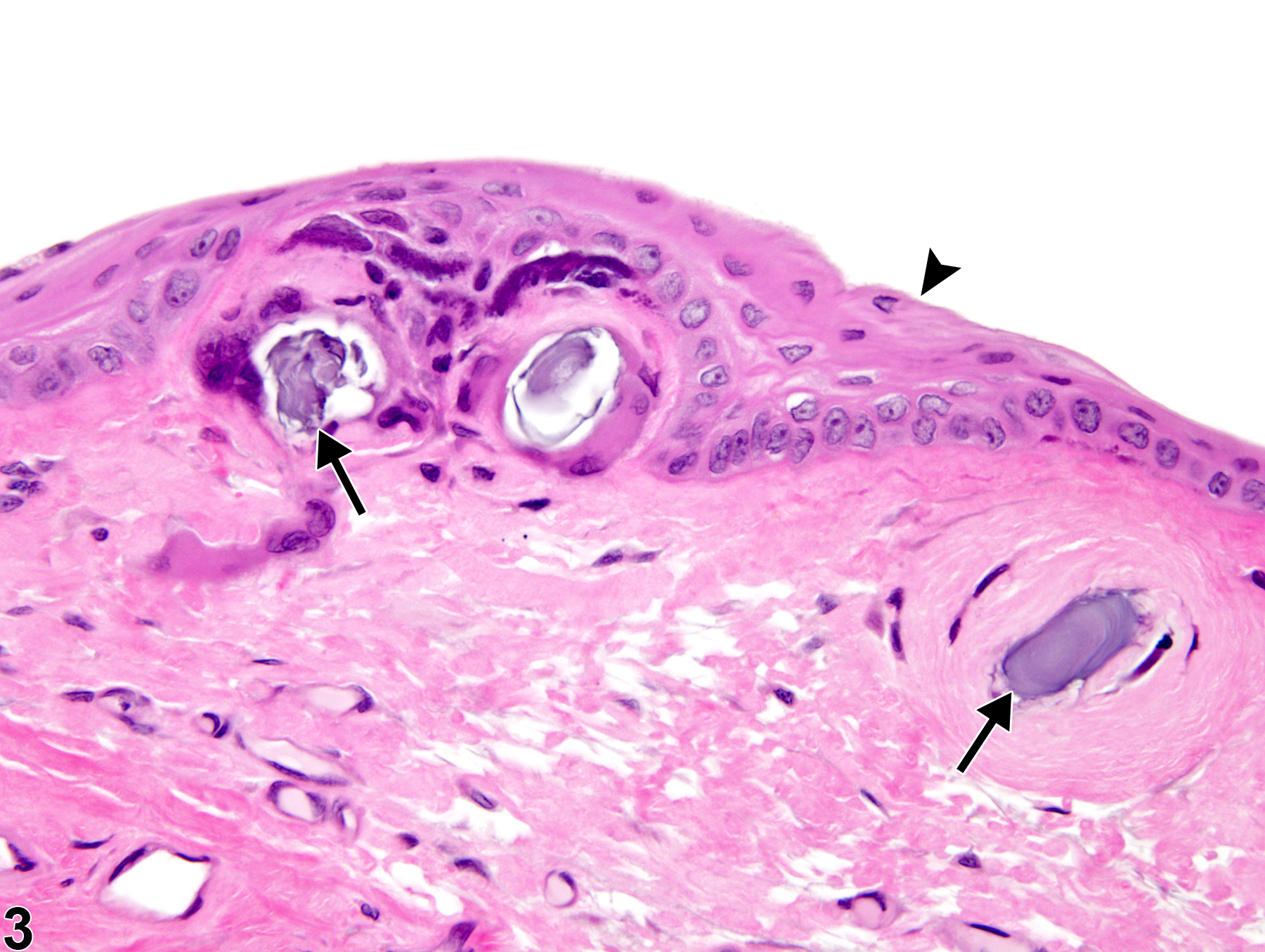 Image of cornea mineralization in the eye from a male F344/N rat in a chronic study