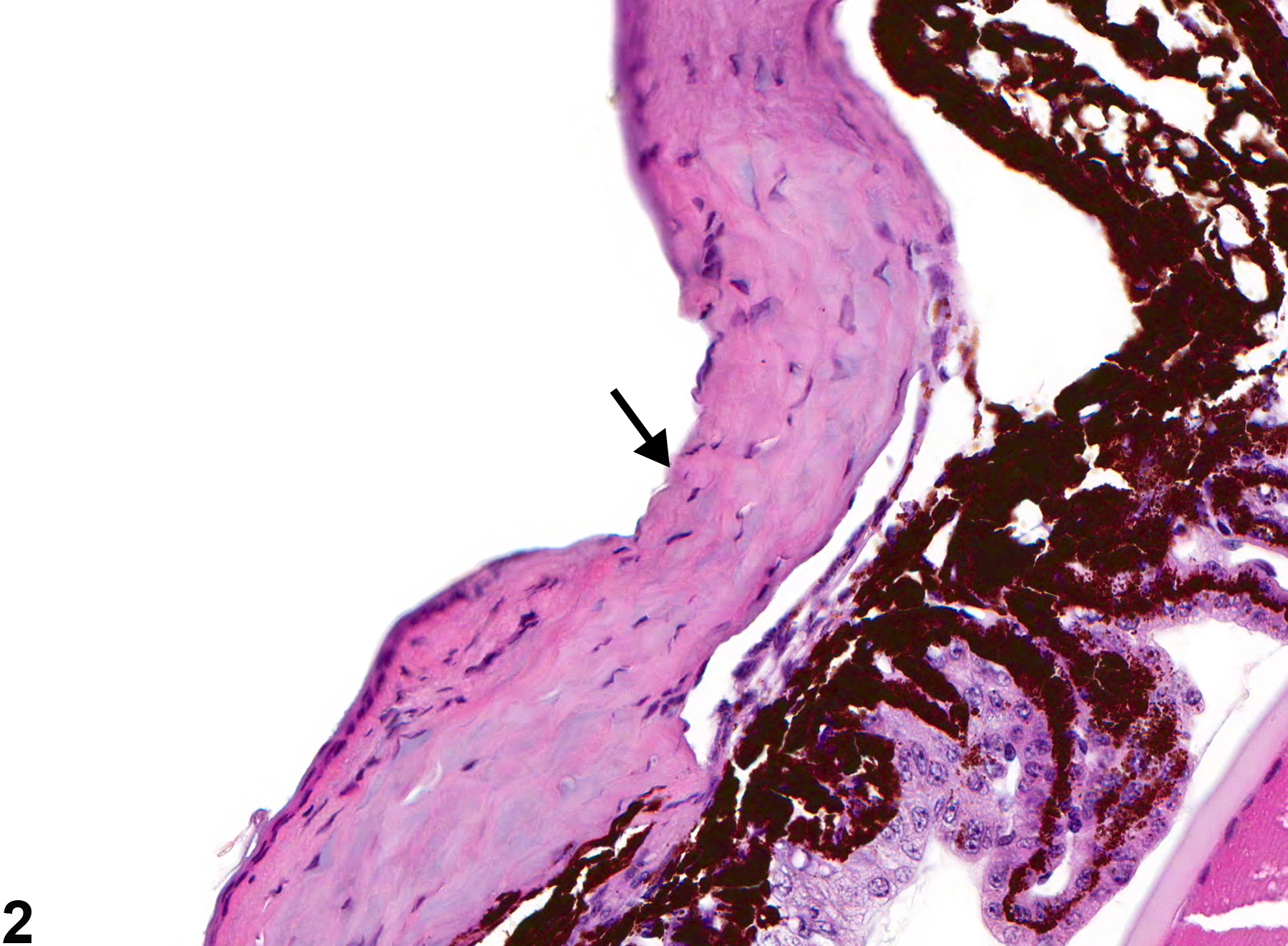 Image of cornea ulcer in the eye from a male B6C3F1 mouse in a subchronic study