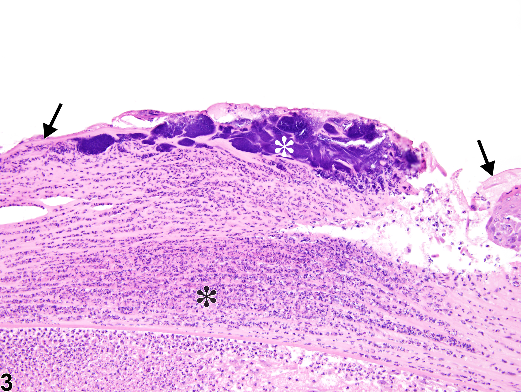Image of cornea ulcer in the eye from a male F344/N rat in a subchronic study