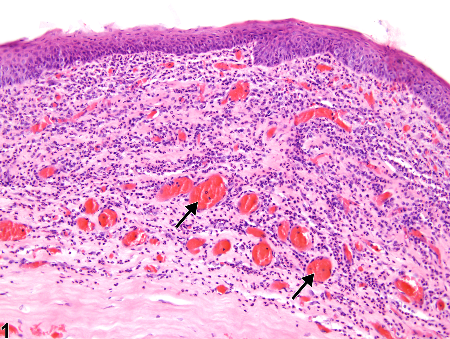 Image of inflammation in the eye from a male F344/N rat in a chronic study