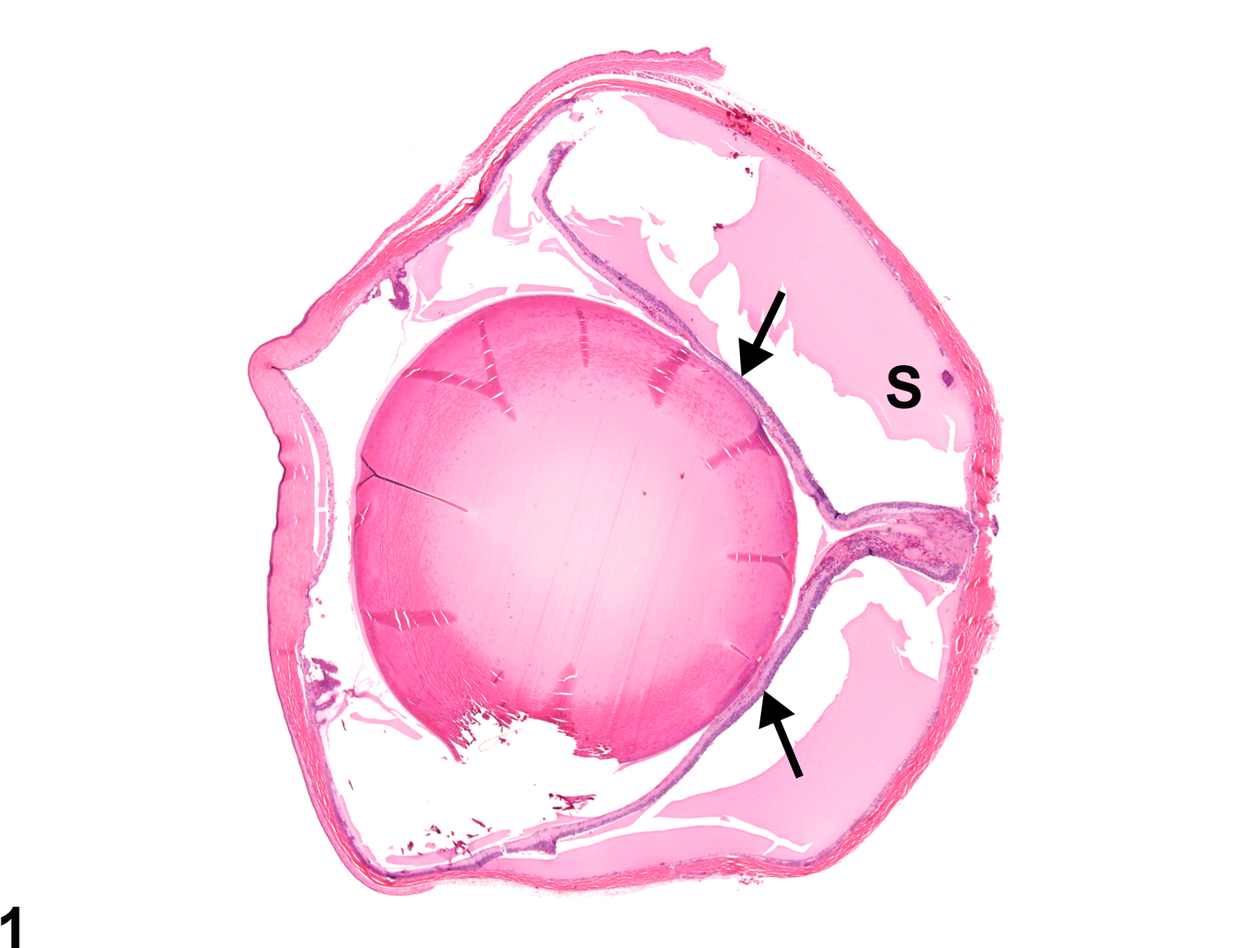 Image of retina detachment in the eye from a female F344/N rat in a chronic study