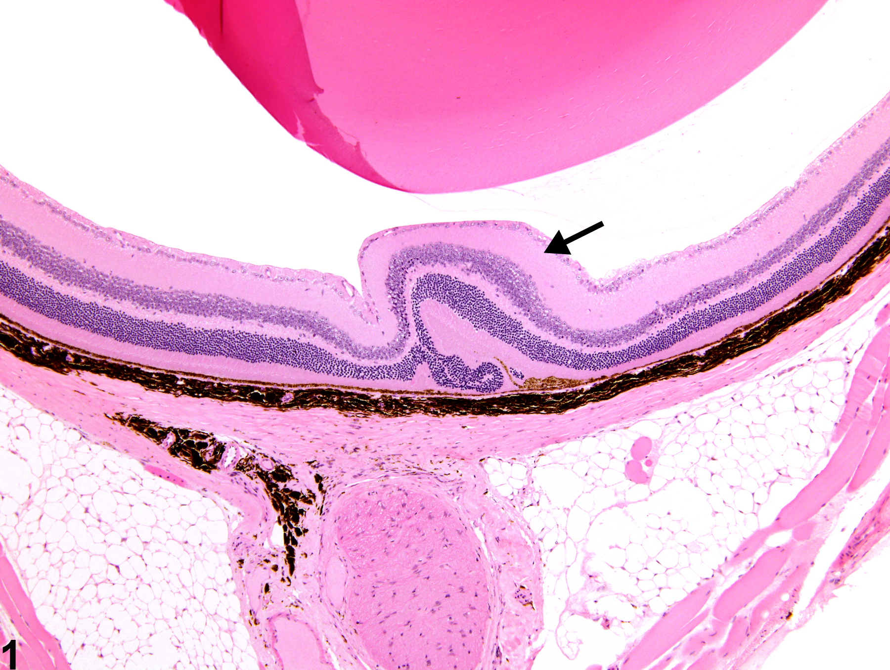 Image of retina dysplasia in the eye from a female B6C3F1 mouse in a chronic study