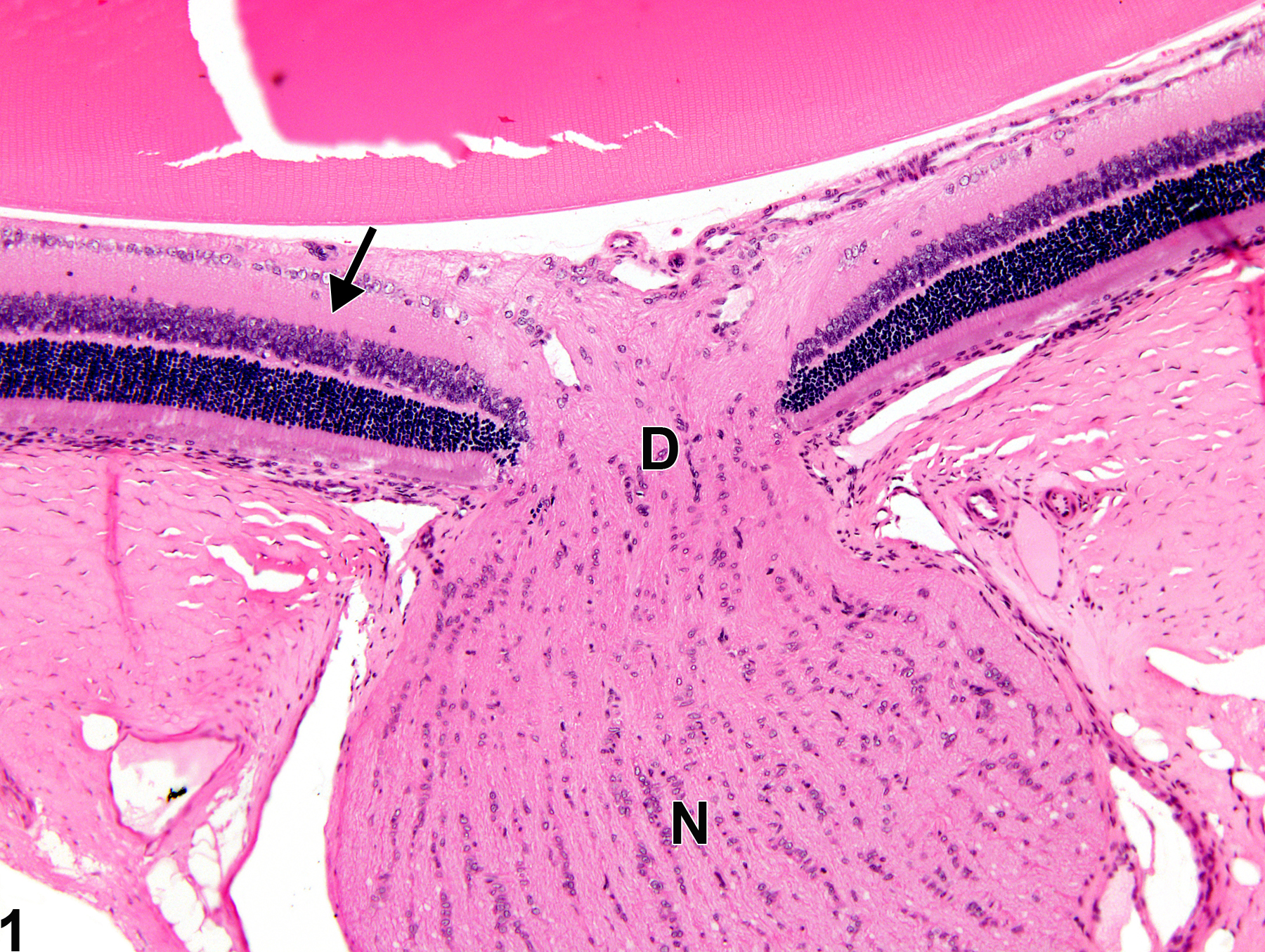Image of retina gliosis in the eye from a female F344/N rat in a chronic study