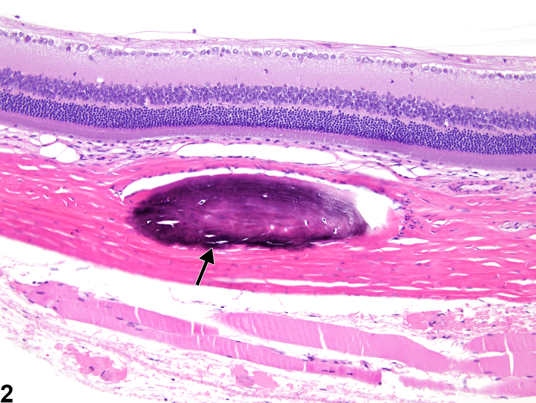 Image of sclera metaplasia, osseous in the eye from a male F344/N rat in a chronic study