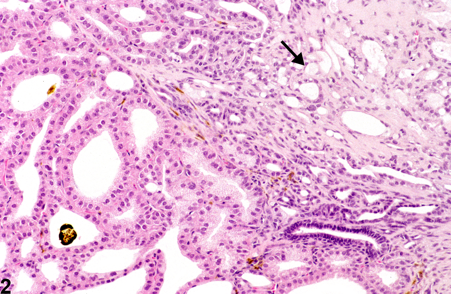 Image of atrophy in the Harderian gland from a female B6C3F1 mouse in a chronic study