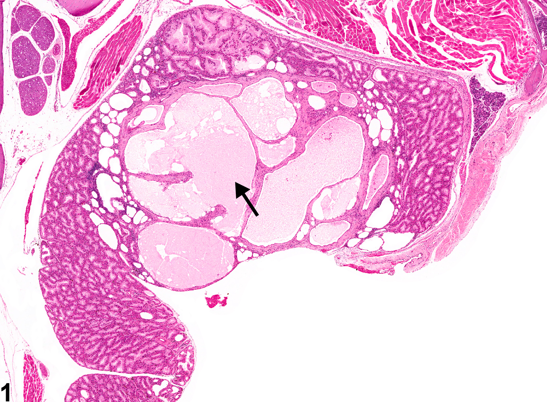 Image of cyst in the Harderian gland from a male B6C3F1 mouse in a chronic study