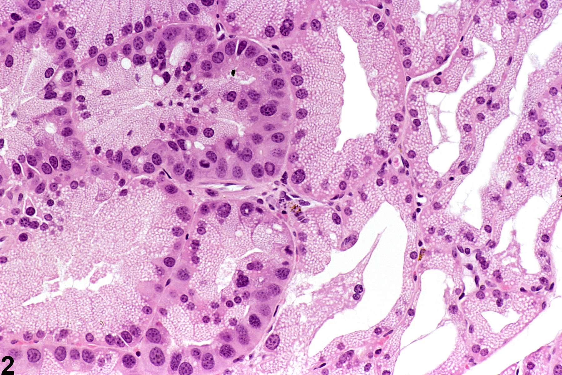 Image of hyperplasia in the Harderian gland from a male B6C3F1 mouse in a chronic study