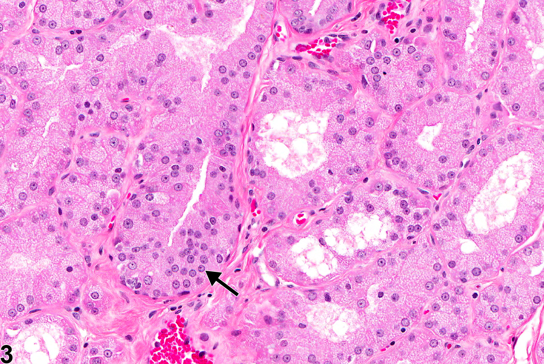 Image of hyperplasia in the Harderian gland from a male F344/N rat in a chronic study