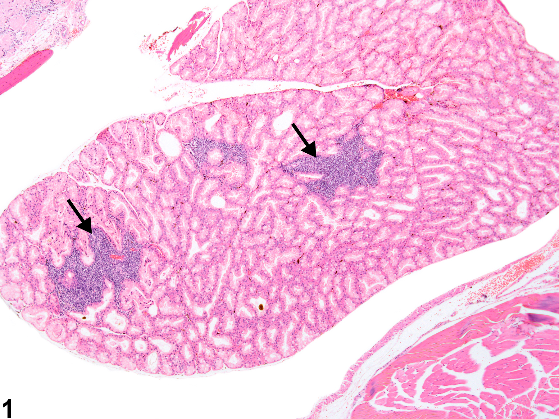 Image of infiltration cellular, mononuclear cell in the Harderian gland from a female B6C3F1 mouse in a chronic study