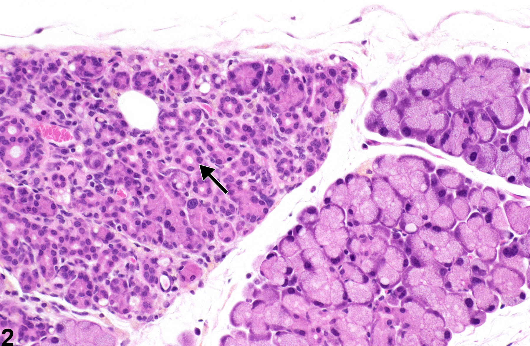 Image of atrophy in the lacrimal gland from a male B6C3F1 mouse in a chronic study