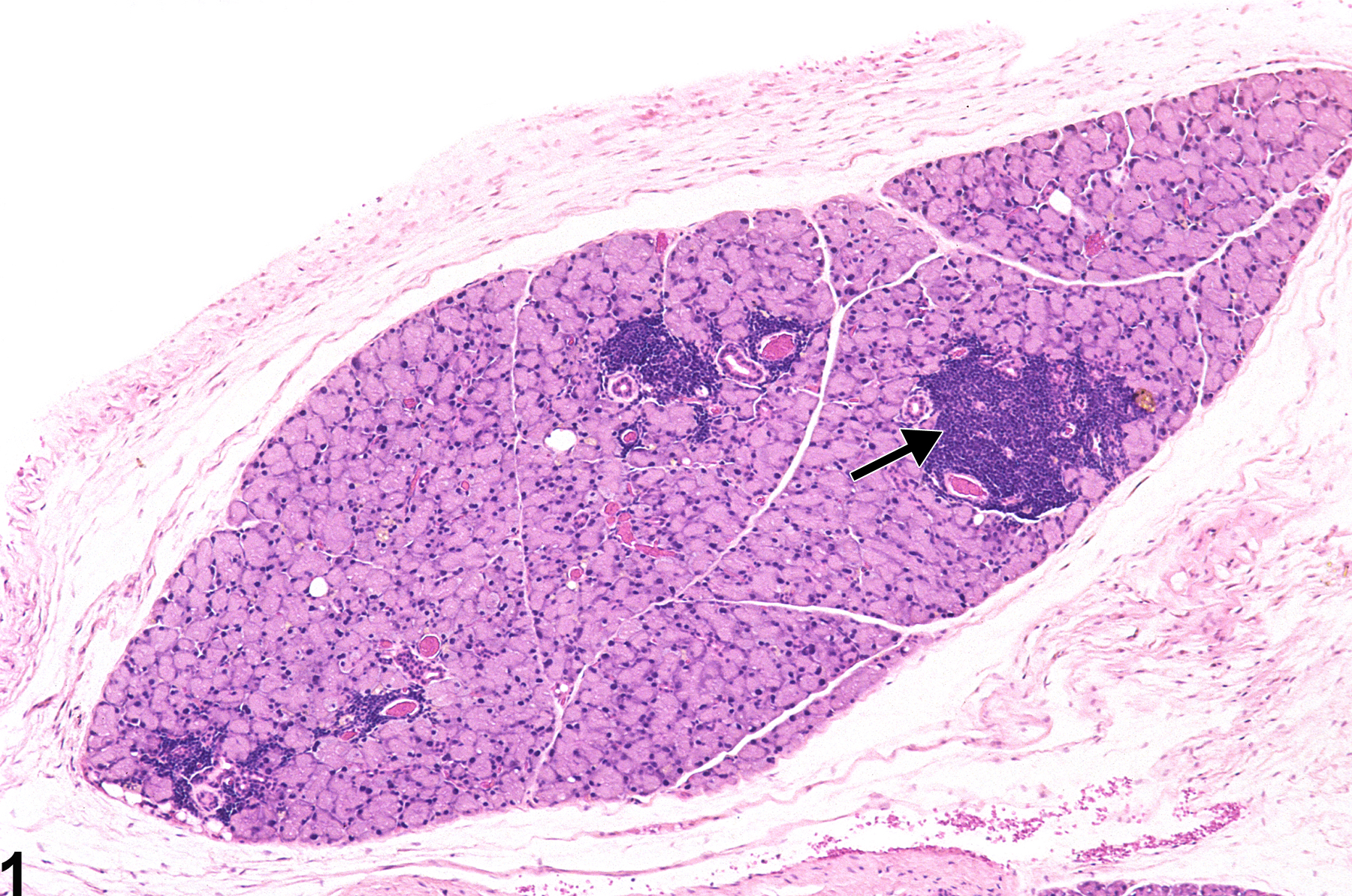 Image of infiltration cellular, mononuclear cell in the lacrimal gland from a male B6C3F1 mouse in a chronic study
