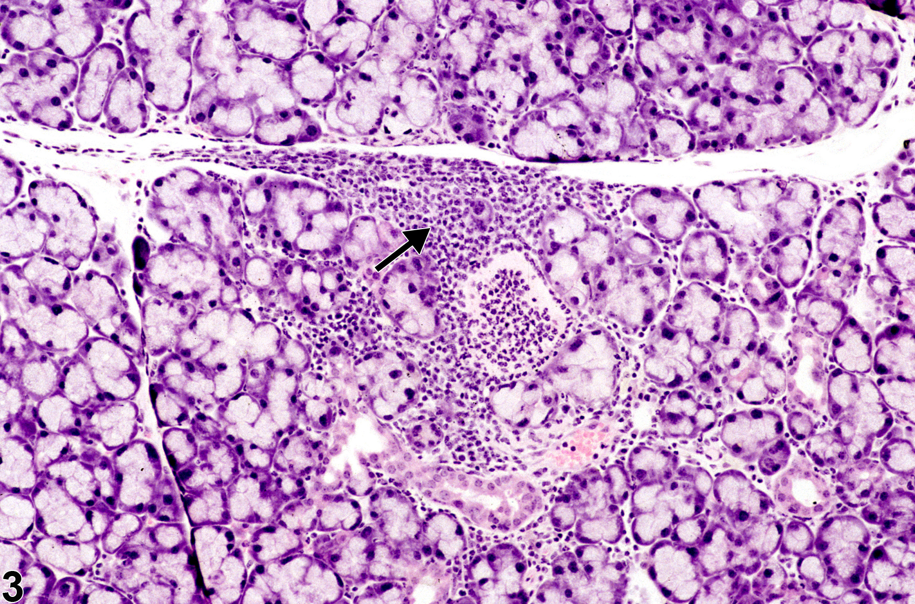Image of inflammation in the lacrimal gland from a female B6C3F1 mouse in a chronic study