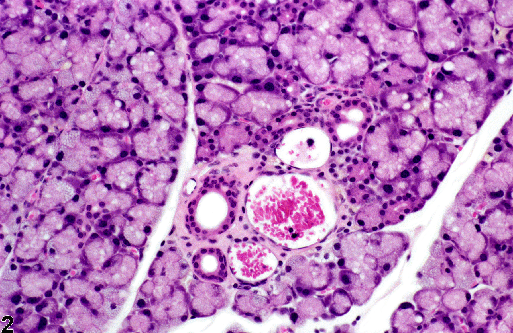 Image of karyomegaly in the lacrimal gland from a male B6C3F1 mouse in a chronic study