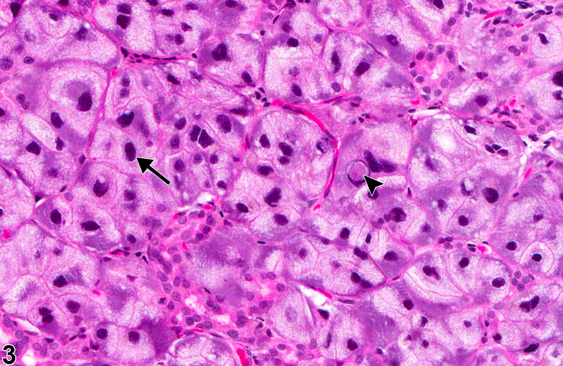Image of karyomegaly in the lacrimal gland from a male Osborne Mendel rat in a chronic study