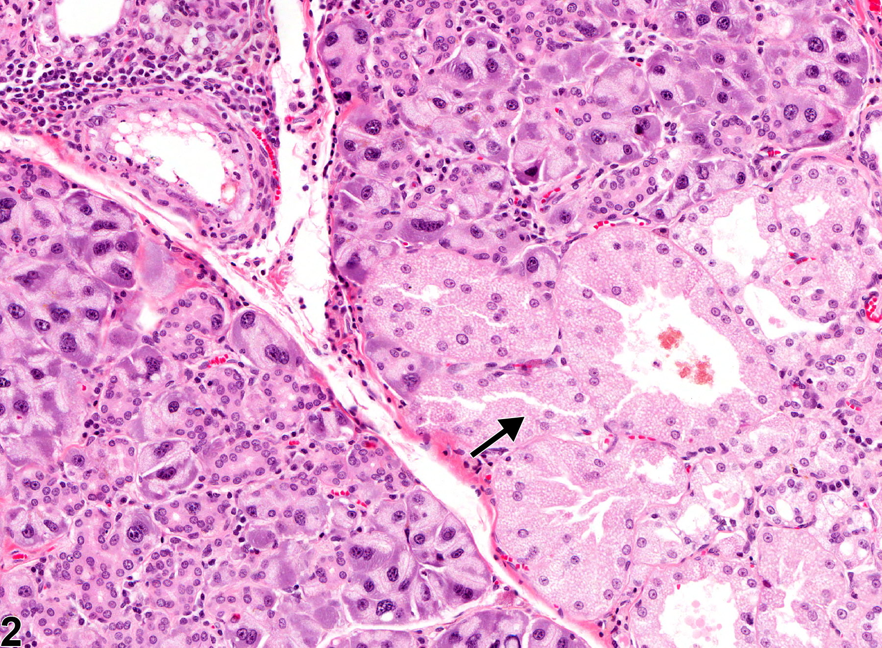 Image of metaplasia, harderian in the lacrimal gland from a male Osborne Mendel rat in a chronic study