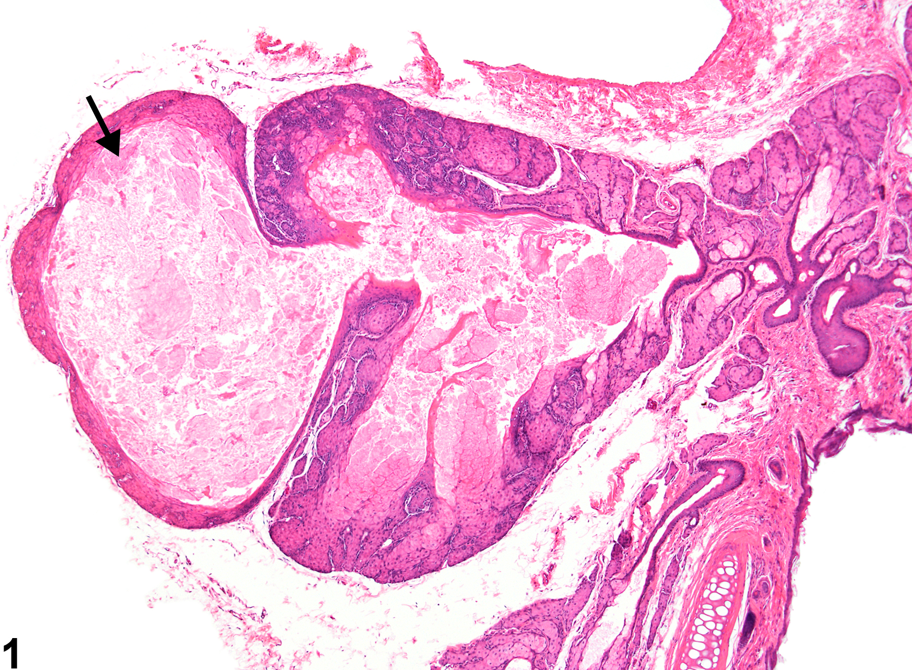 Image of duct cyst in the Zymbal's gland from a female F344/N rat in a chronic study