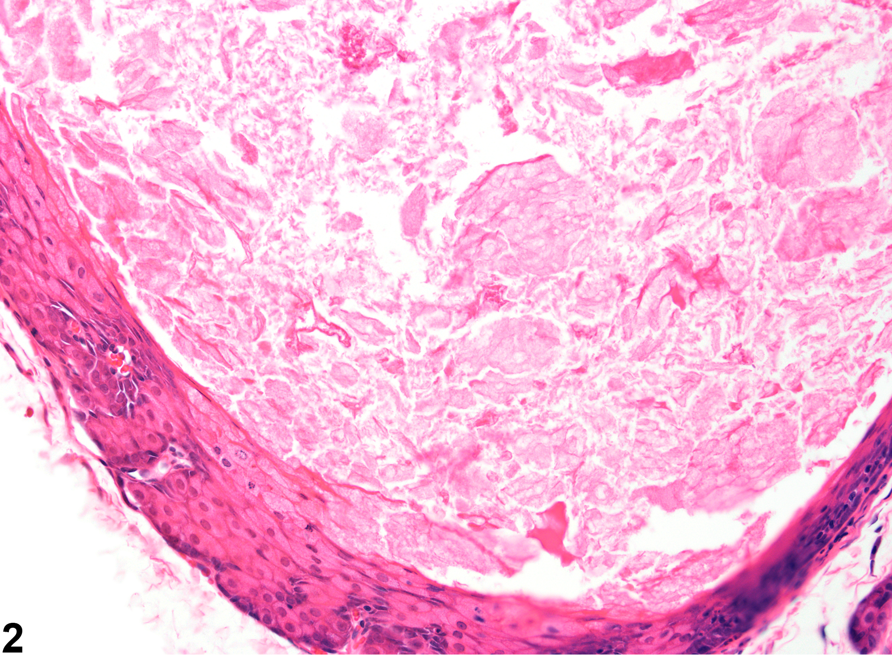 Image of duct cyst in the Zymbal's gland from a female F344/N rat in a chronic study