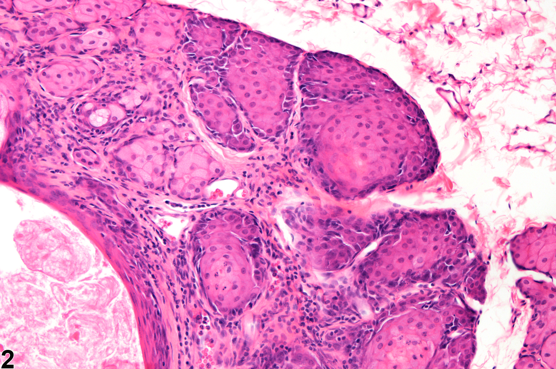 Image of hyperplasia in the Zymbal's gland from a female F344/N rat in a chronic study