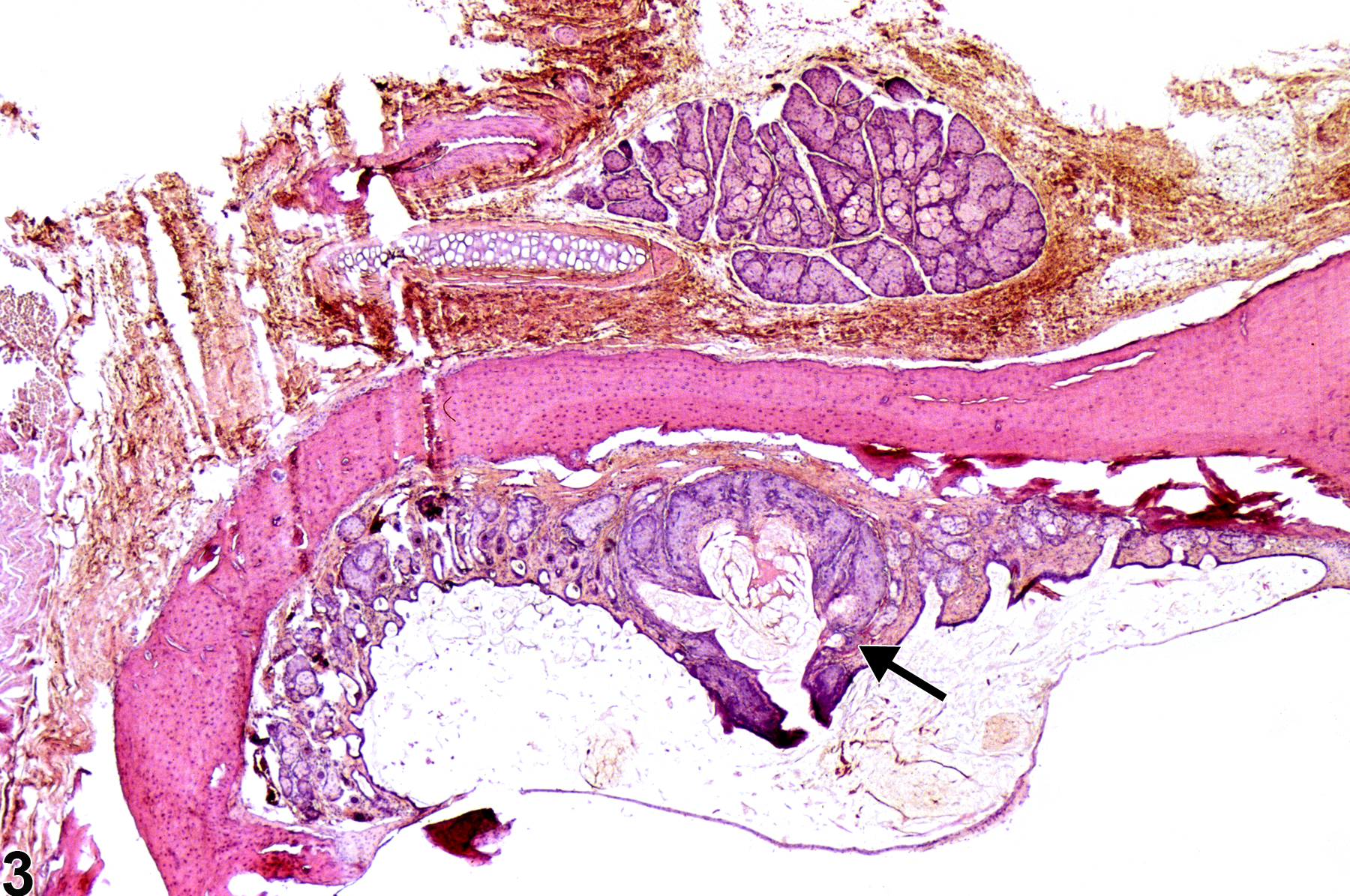 Image of hyperplasia in the Zymbal's gland from a male F344/N rat in a chronic study