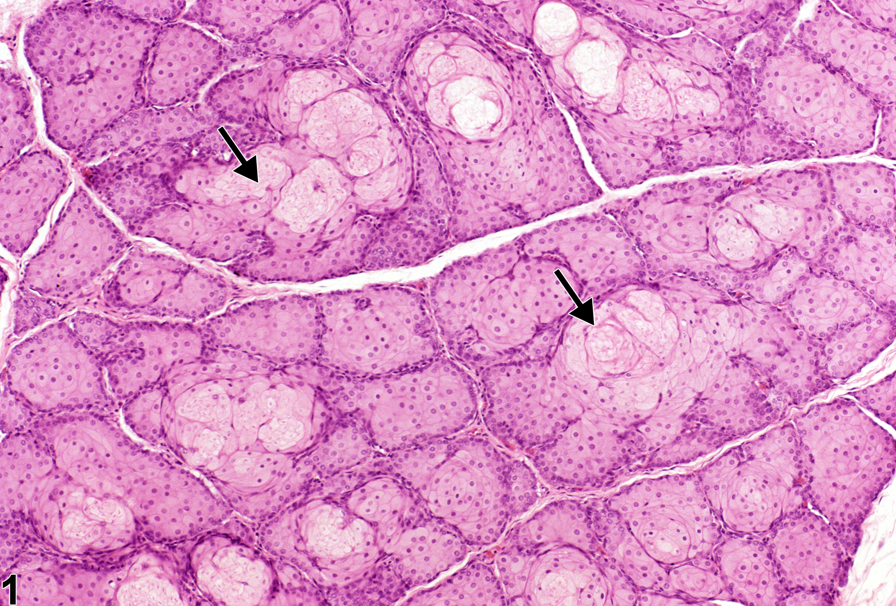 Image of hypertrophy in the Zymbal's gland from a male F344/N rat in a chronic study