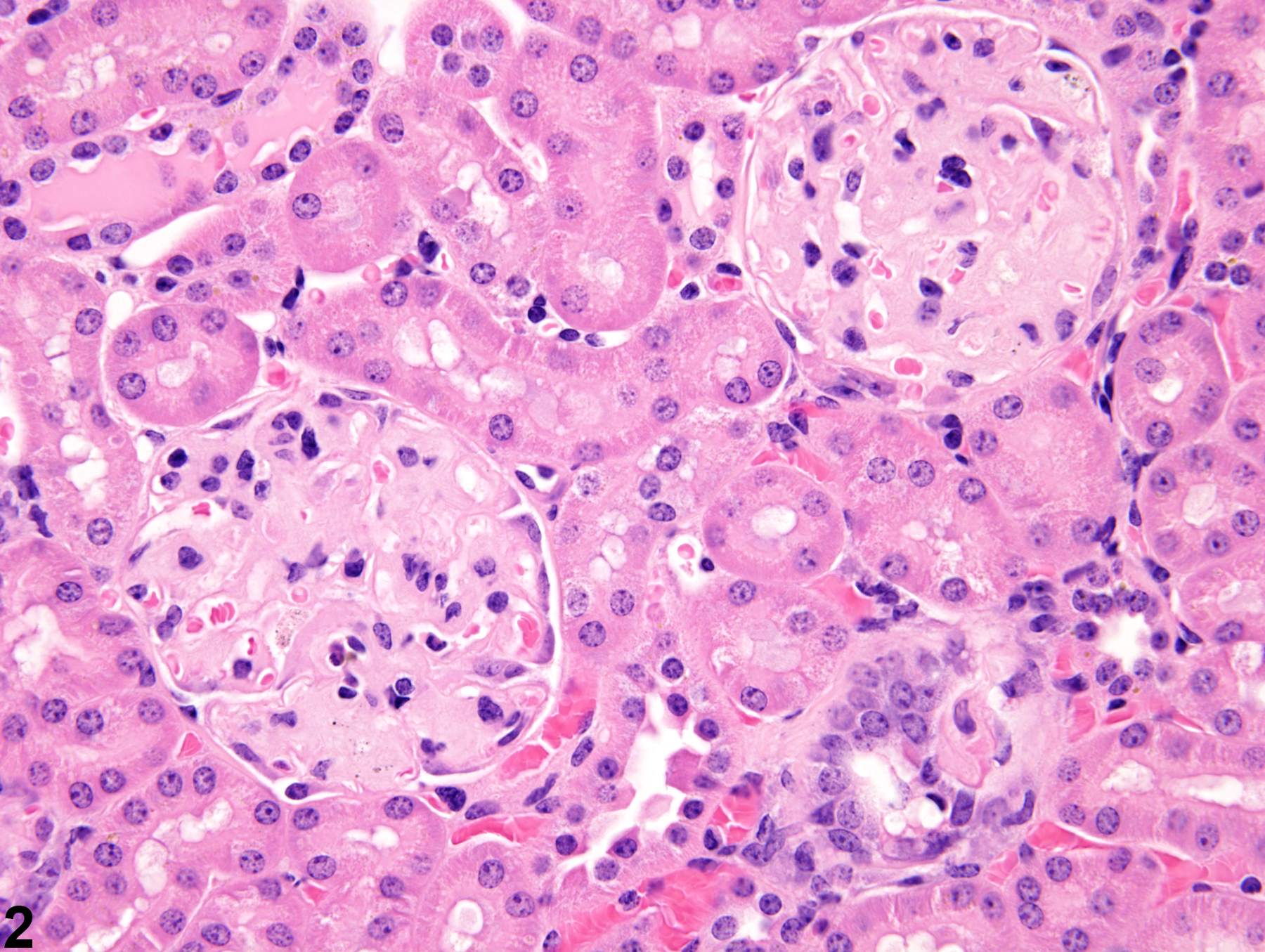 Image of amyloid in the kidney from a female B6C3F1 mouse in a chronic study