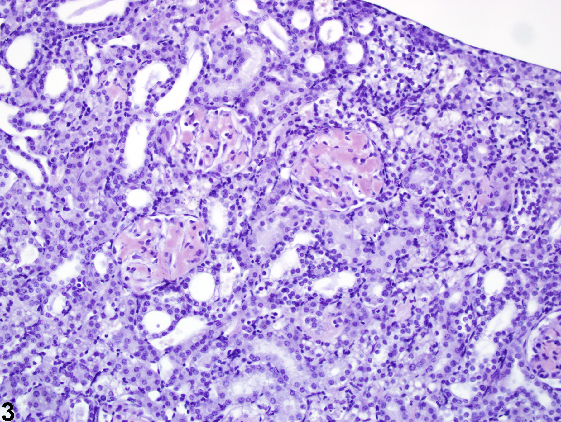 Image of amyloid in the kidney from a  B6C3F1 mouse in a chronic study
