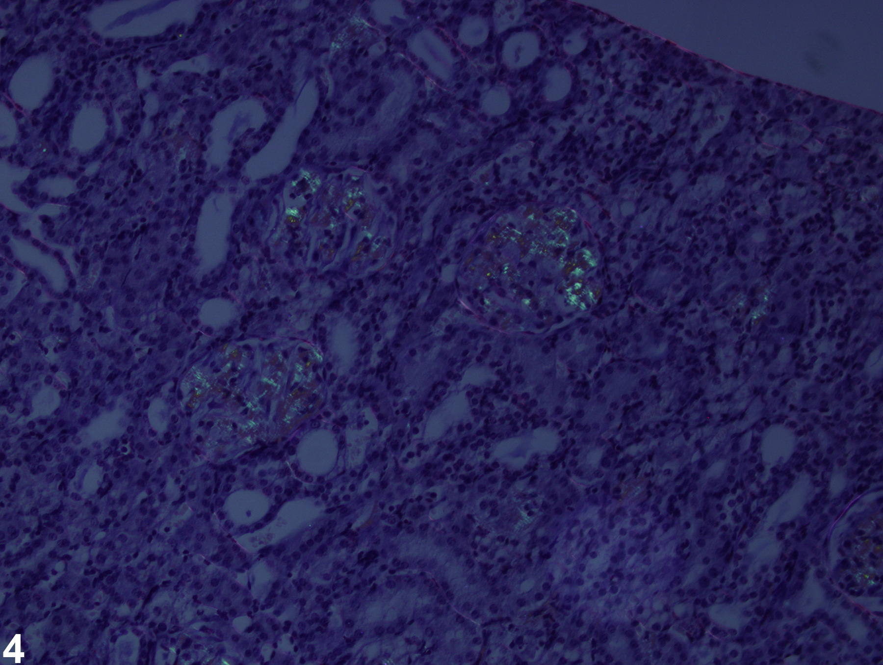 Image of amyloid in the kidney from a  B6C3F1 mouse in a chronic study