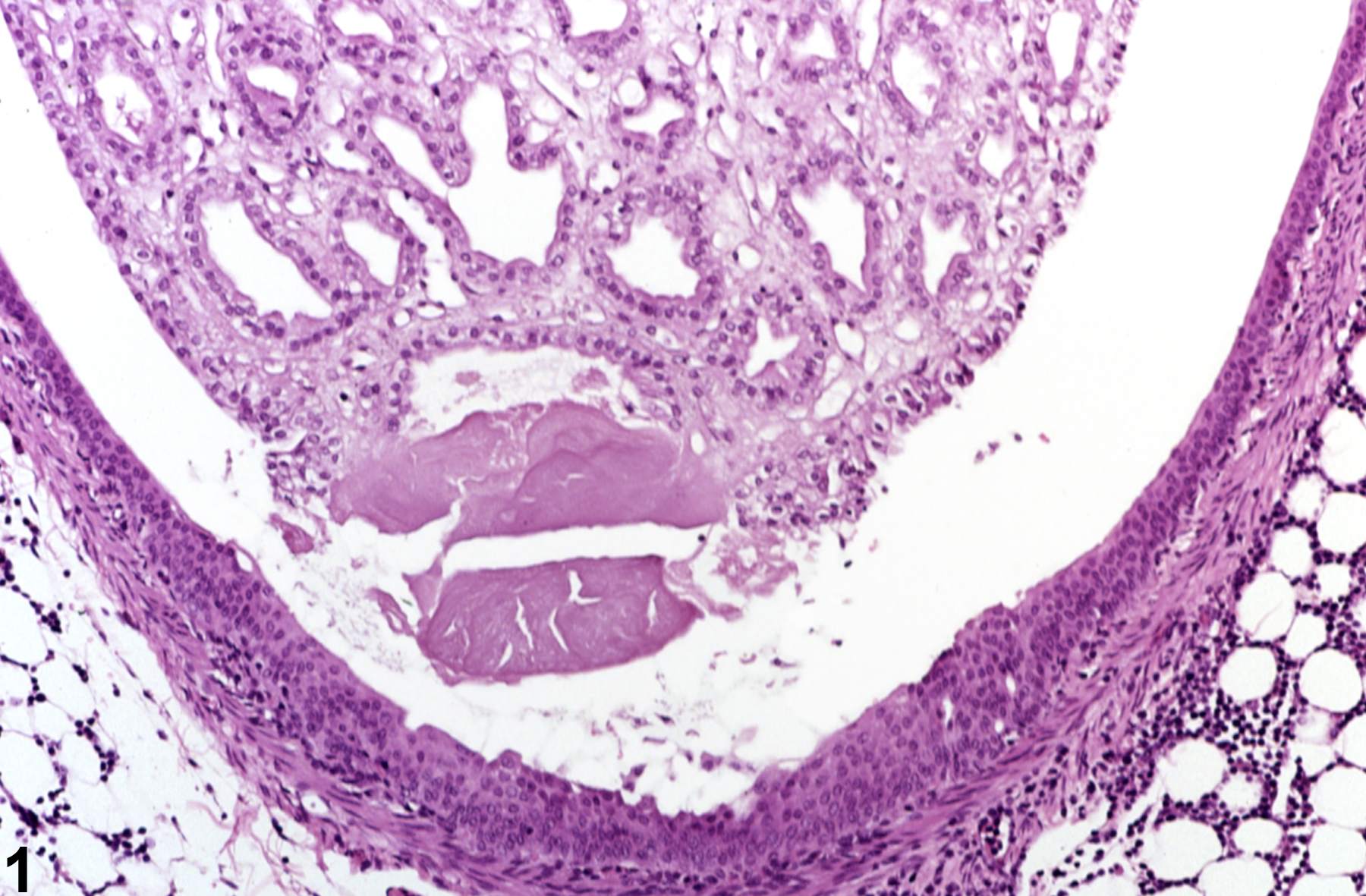 Image of calculus in the kidney from a female F344/N rat in a chronic study