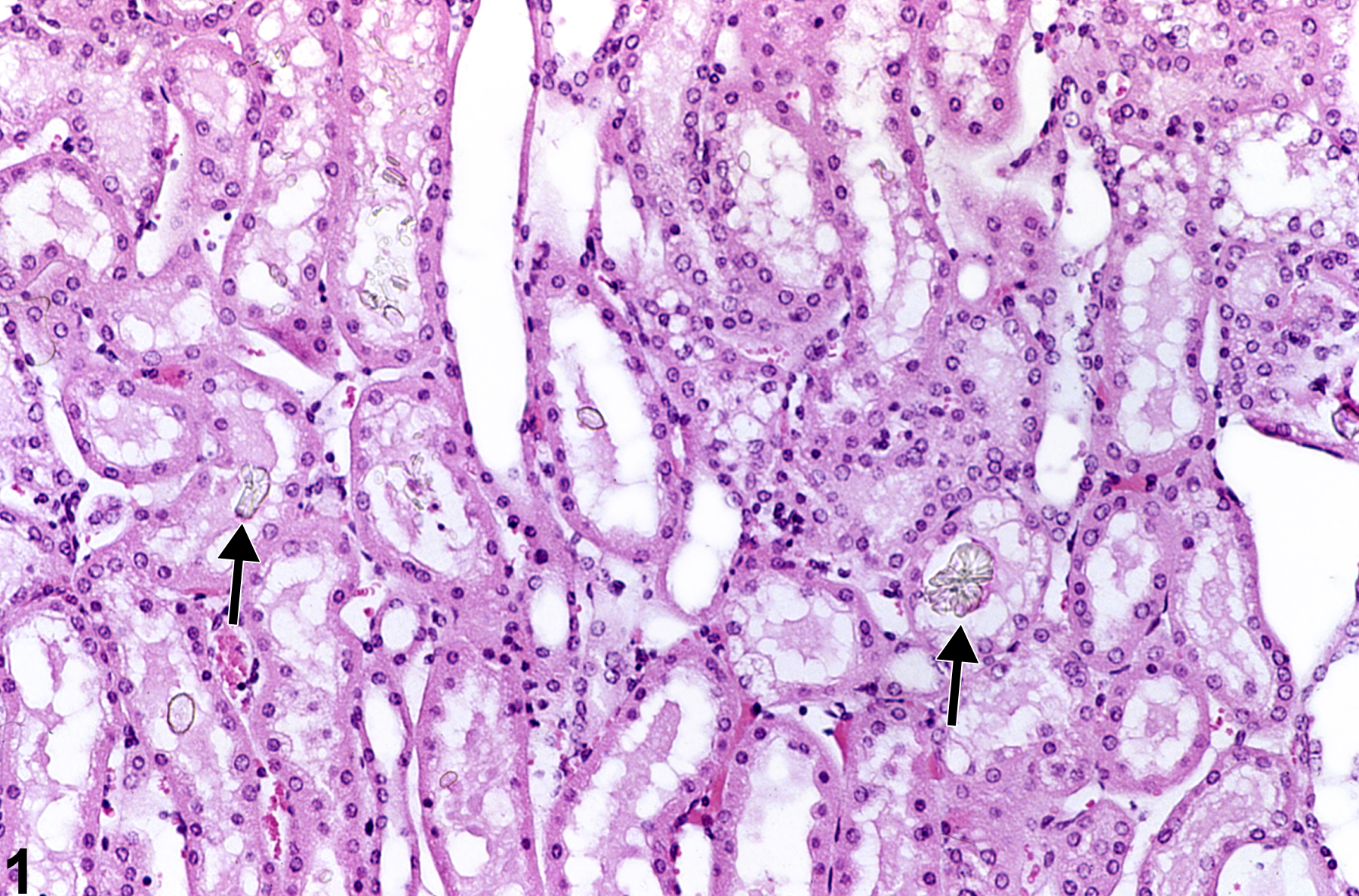 Image of crystal in the kidney from a male B6C3F1 mouse in a chronic study