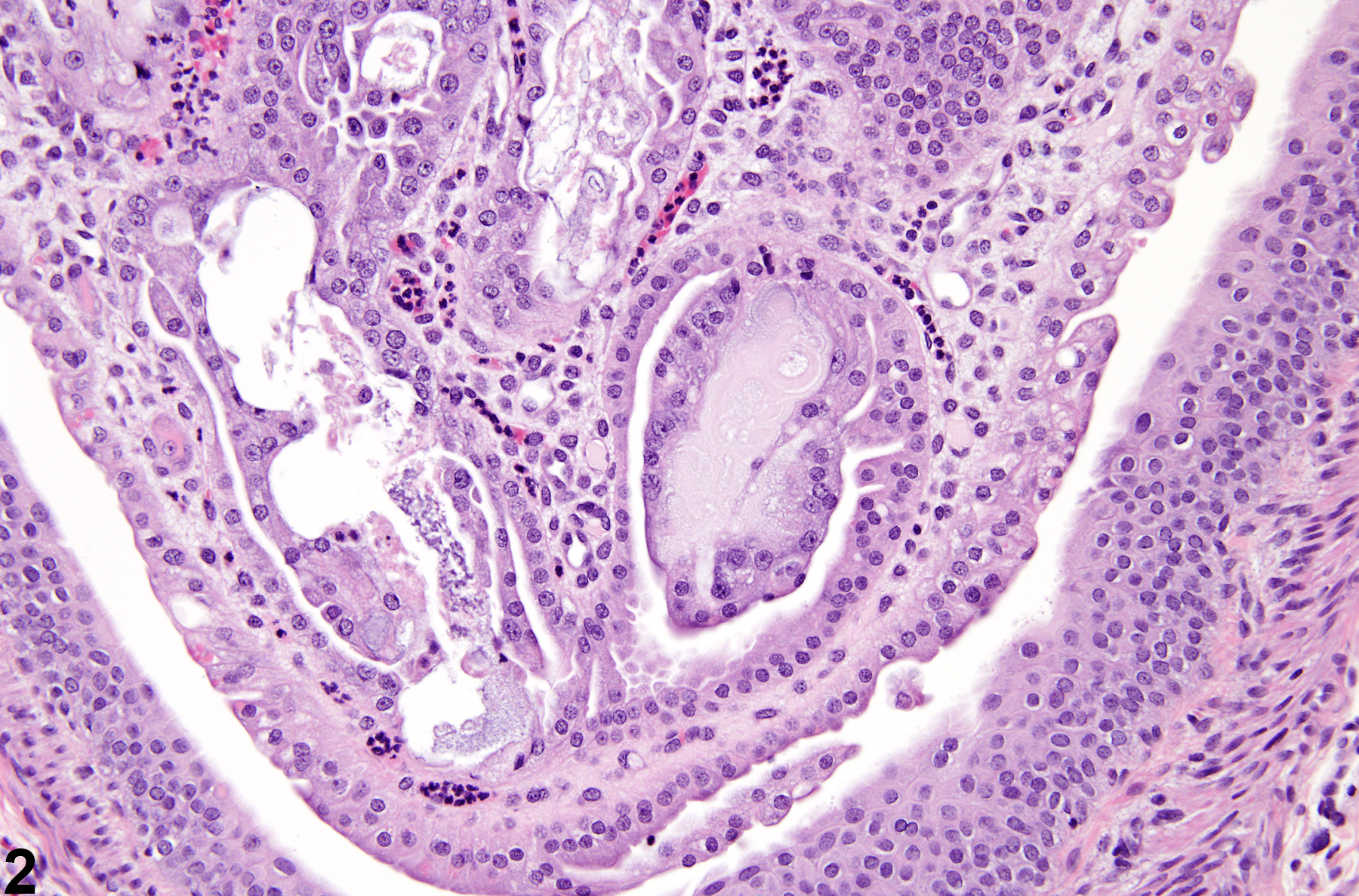 Image of crystal in the kidney from a male  rat in an acute study