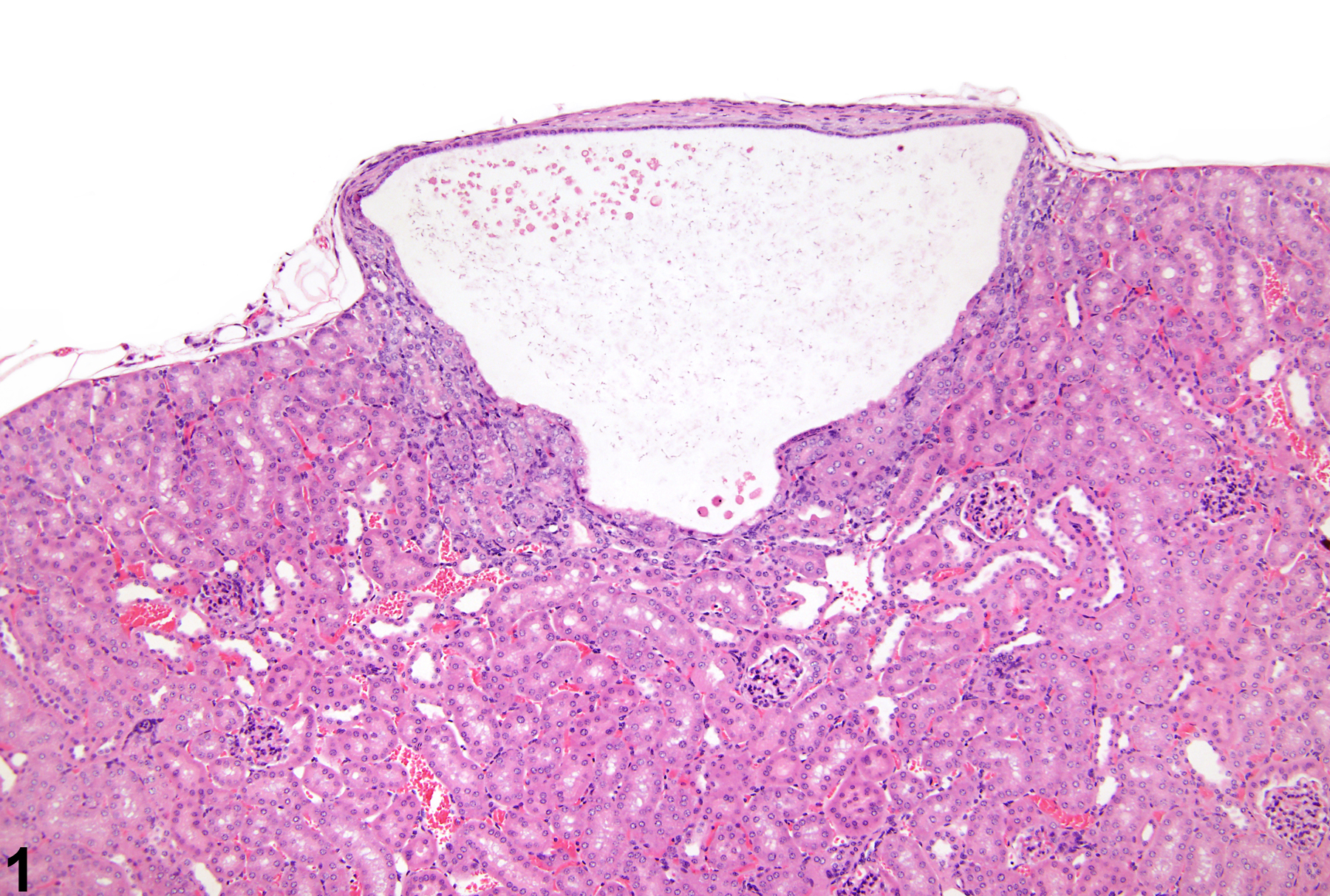 Image of cyst in the kidney from a male Tg.Ac (FVB/N) hemizygous mouse in a subchronic study