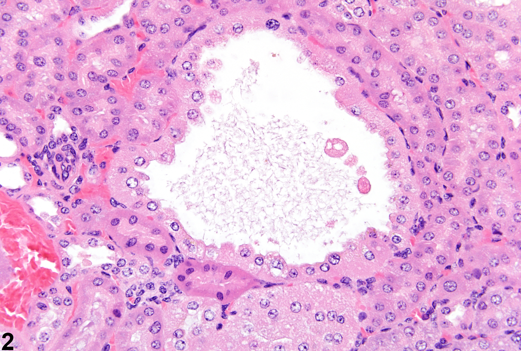Image of cyst in the kidney from a male Tg.Ac (FVB/N) hemizygous mouse in a subchronic study