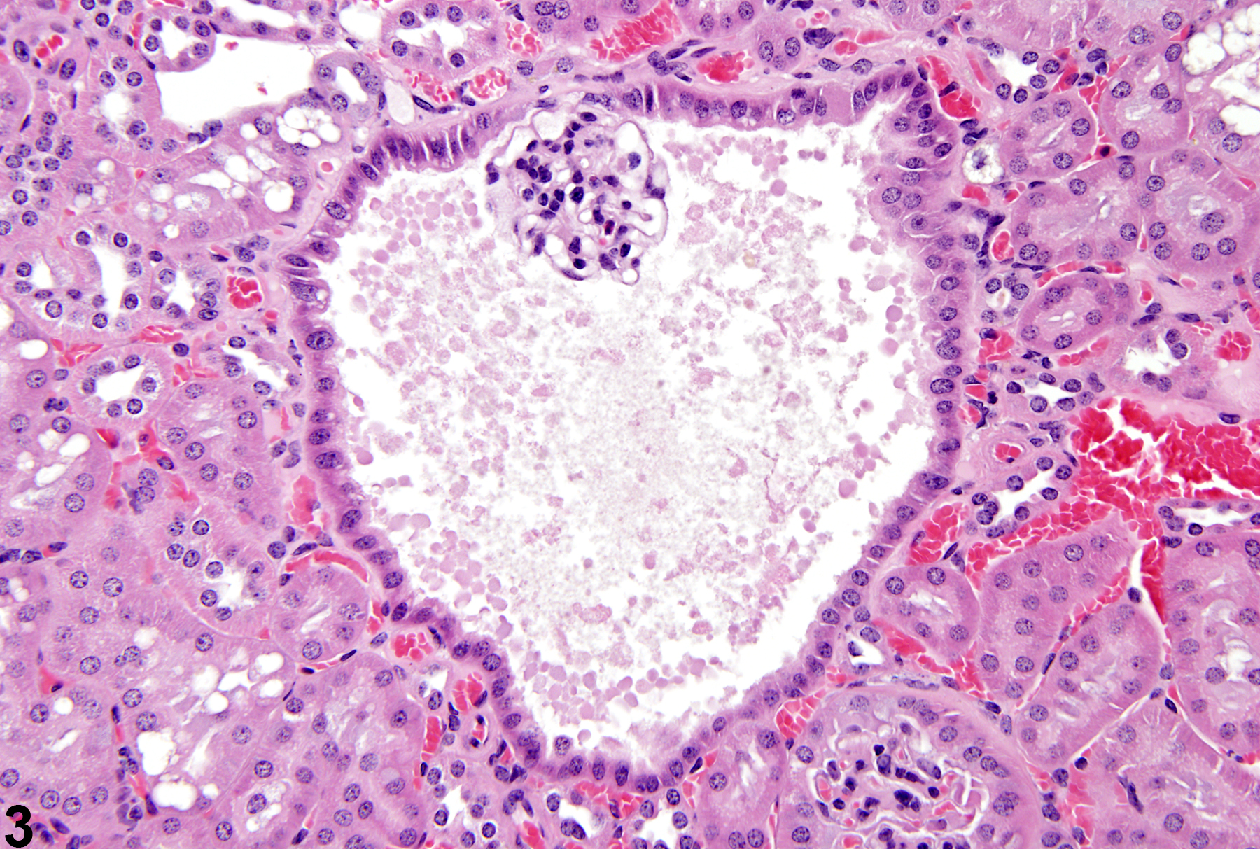 Image of cyst in the kidney from a male B6C3F1 mouse in a chronic study