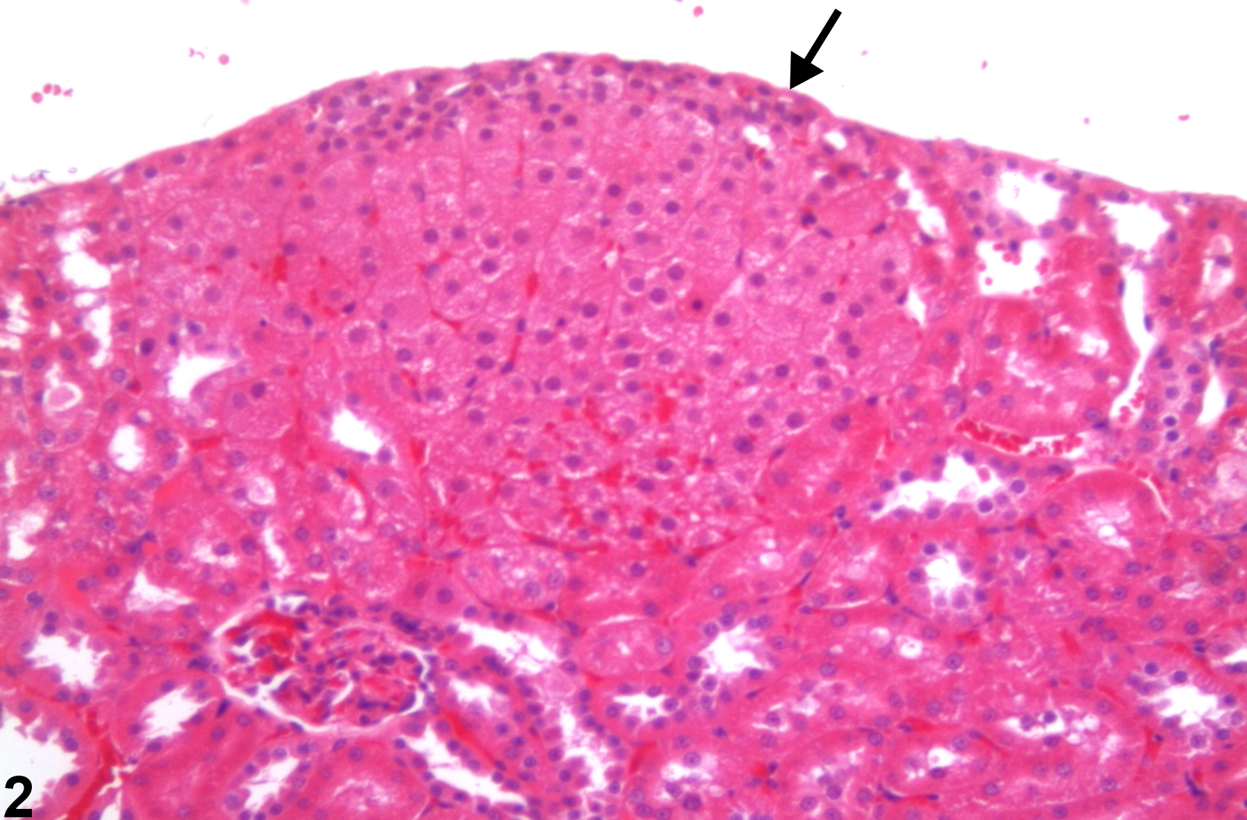 Image of ectopic adrenal tissue in the kidney from a  Harlan Sprague-Dawley rat in a  study