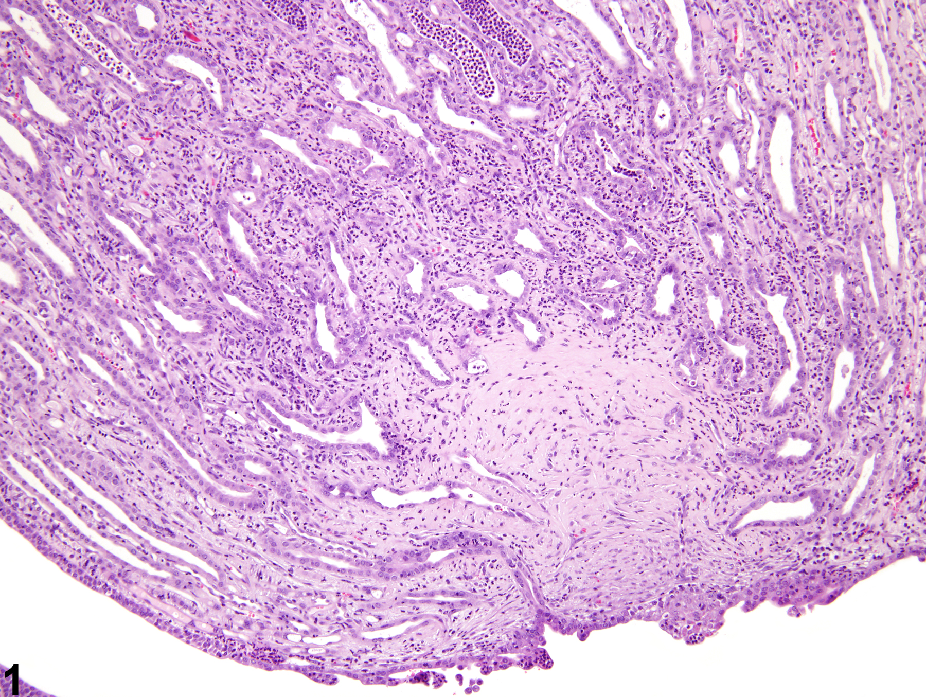Image of fibrosis in the kidney from a female F344/N rat in a chronic study