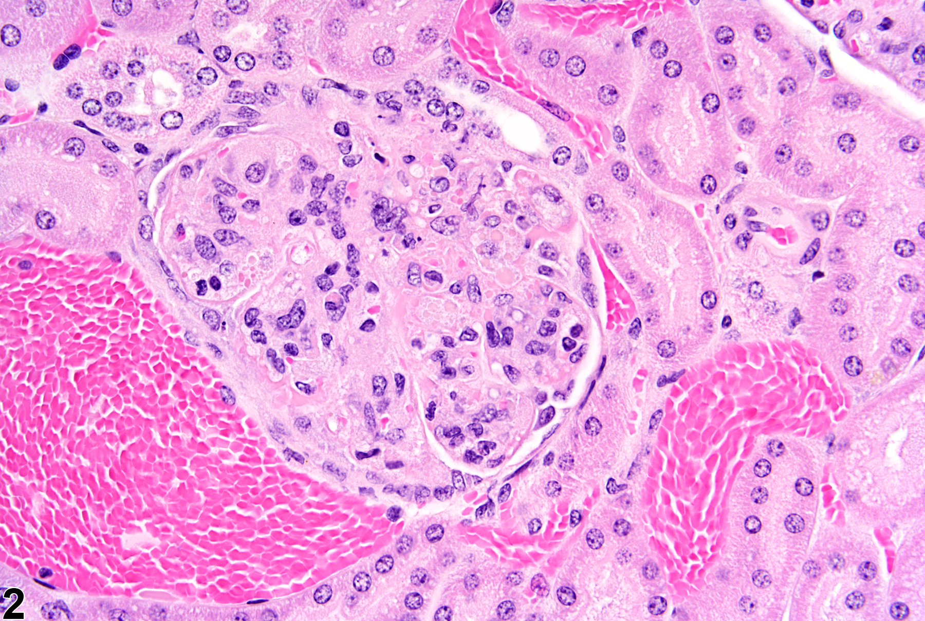 Image of glomerulonephritis in the kidney from a female B6C3F1 mouse in a chronic study