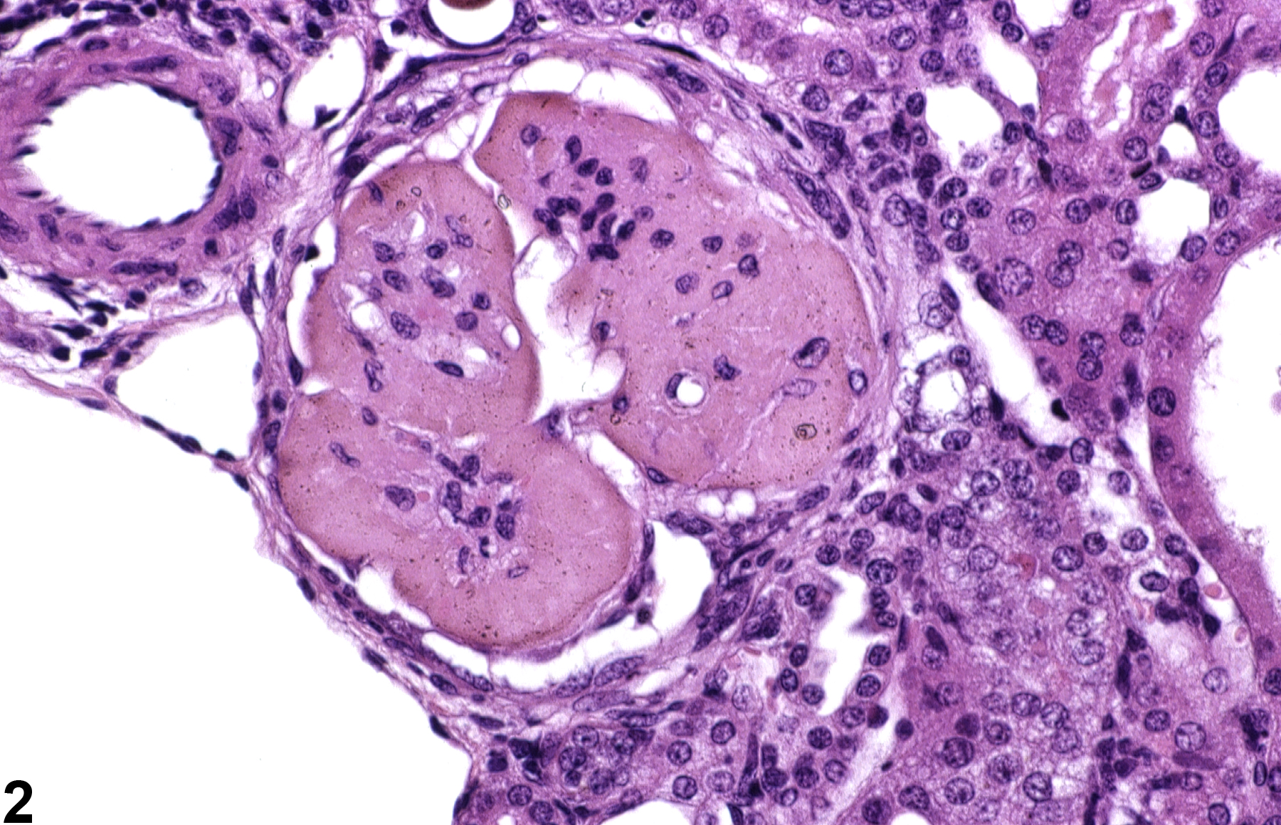 Image of hyaline glomerulopathy in the kidney from a female B6C3F1 mouse in a chronic study