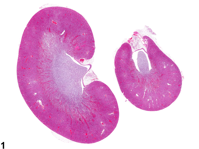 Image of longitudinally sectioned left and cross-sectioned right kidneys