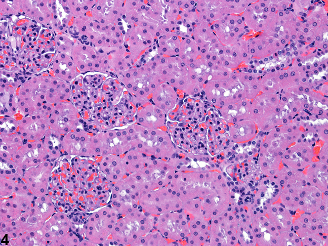 Image of cortical renal tubules and glomeruli in the kidney from a rat