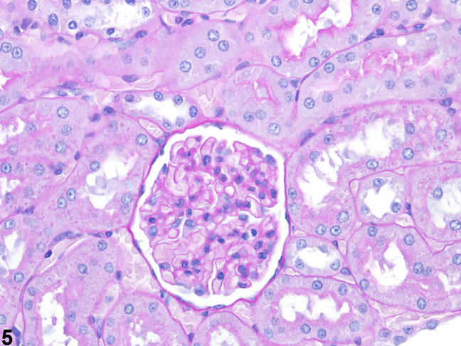 Image of tubule and glomerular basement membranes in the kidney