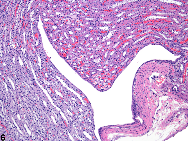 Image of fornices appearing as folds in the kidney