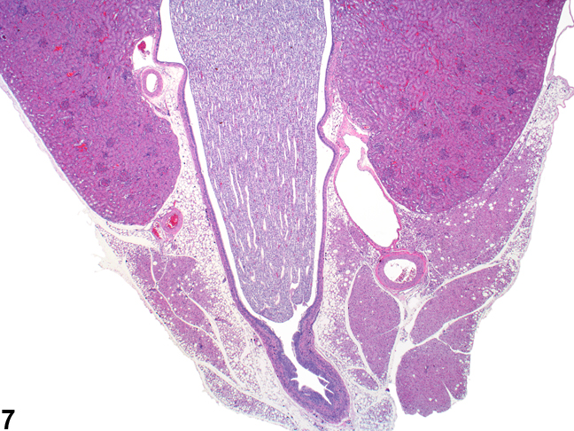 Image of papilla and surrounding renal pelvis with adjacent renal hilar area in the kidney