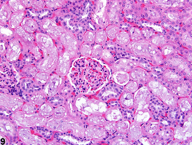 Image of autolysis in the kidney