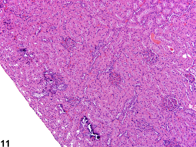Image of artifactual mineralization in the kidney