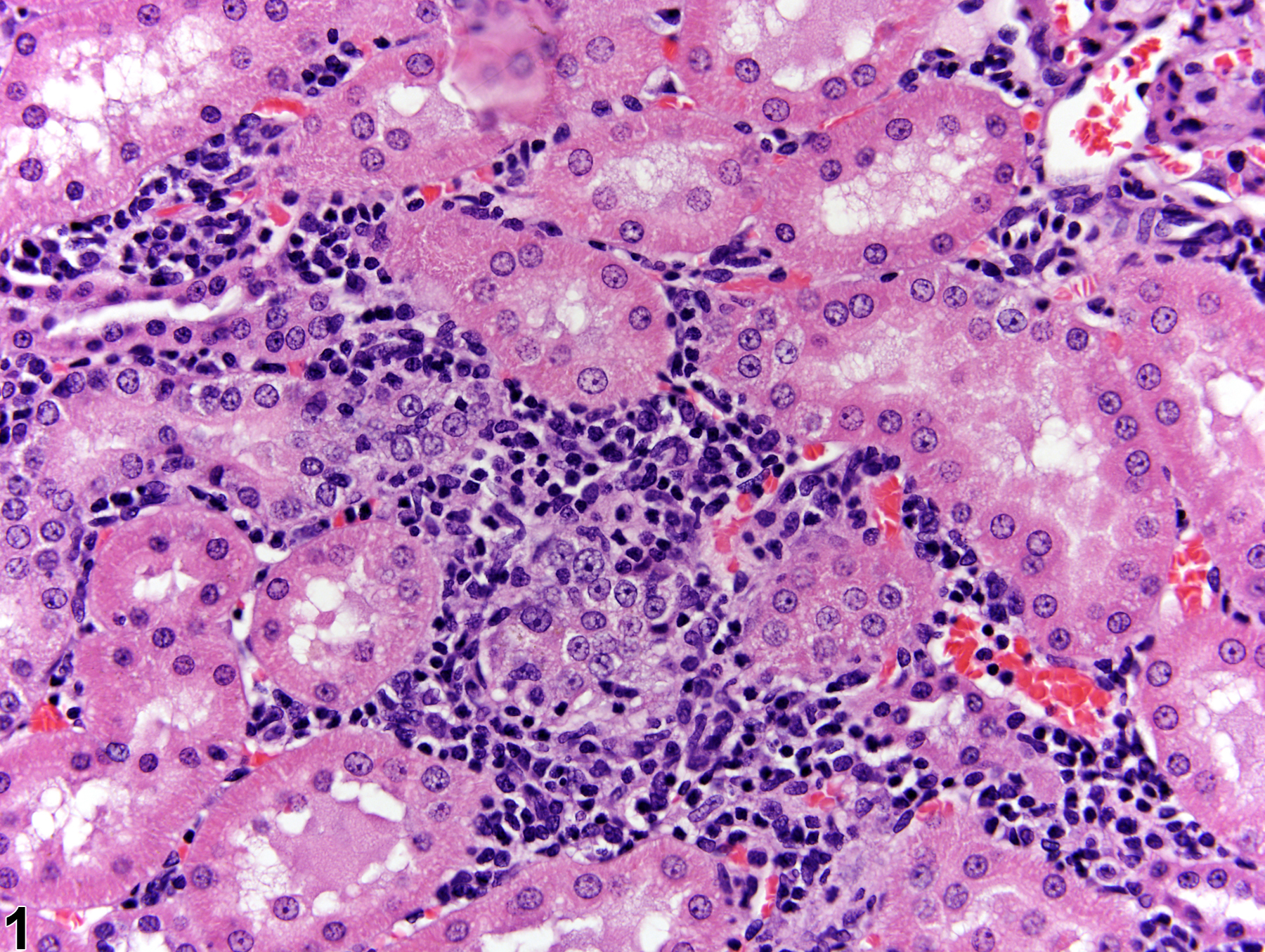 Image of infiltration cellular, lymphocyte in the kidney from a  rat