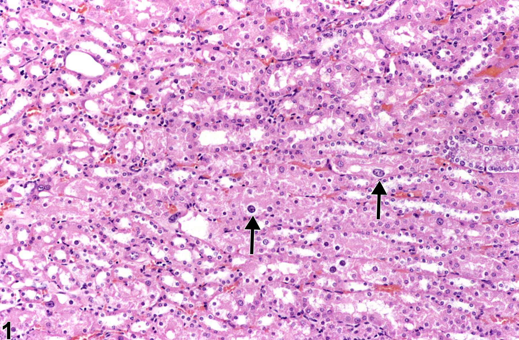 Image of karyomegaly in the kidney from a male B6C3F1 mouse in a chronic study