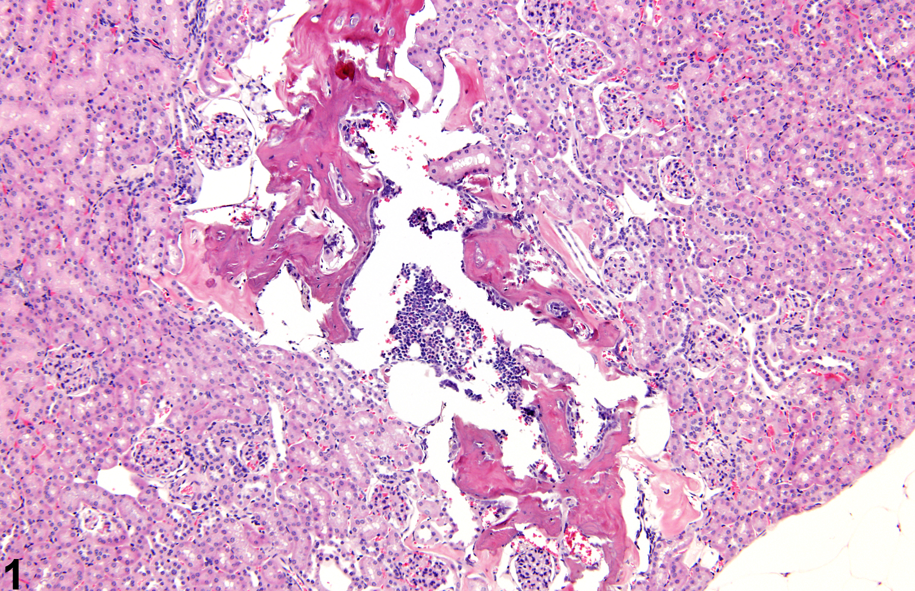Image of metaplasia, osseous in the kidney from a female B6C3F1 mouse in a chronic study