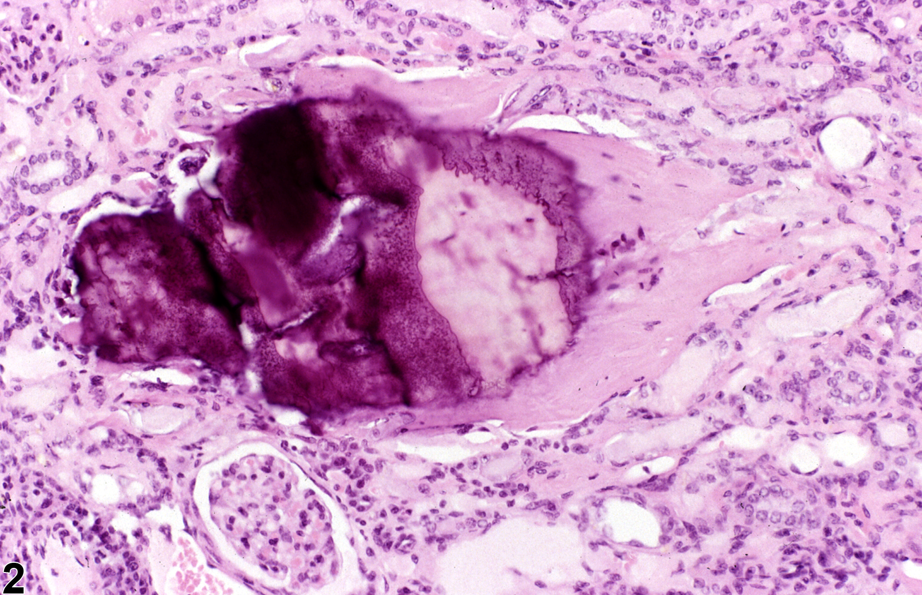 Image of metaplasia, osseous in the kidney from a male B6C3F1 mouse in a chronic study