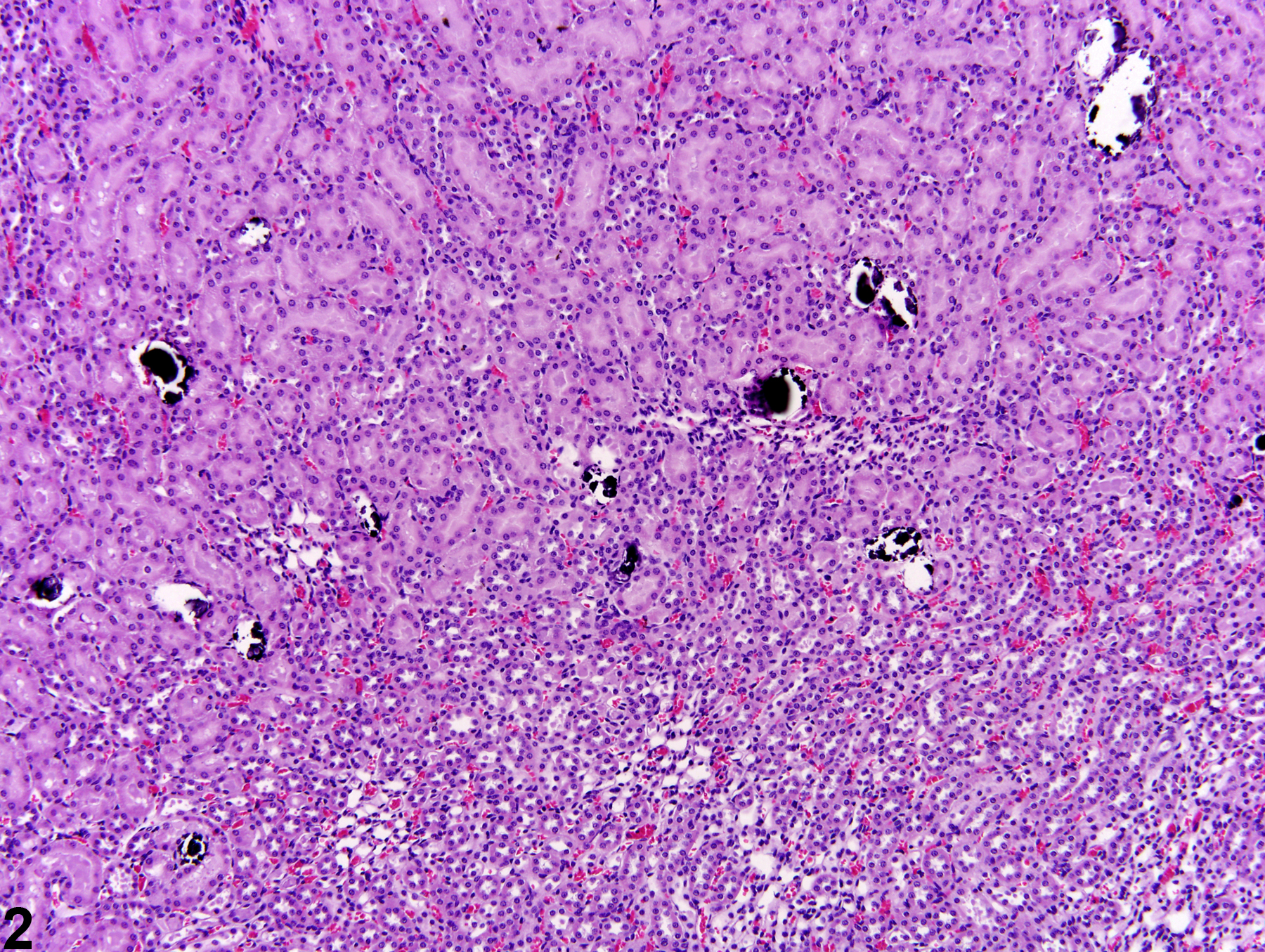 Image of mineralization in the kidney from a female Harlan Sprague-Dawley rat in an acute study