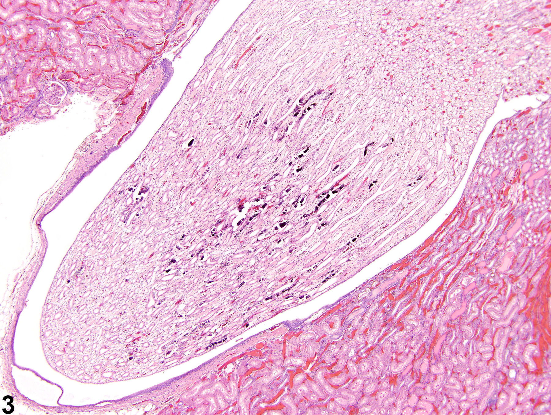 Image of mineralization in the kidney from a male F344/N rat in a chronic study